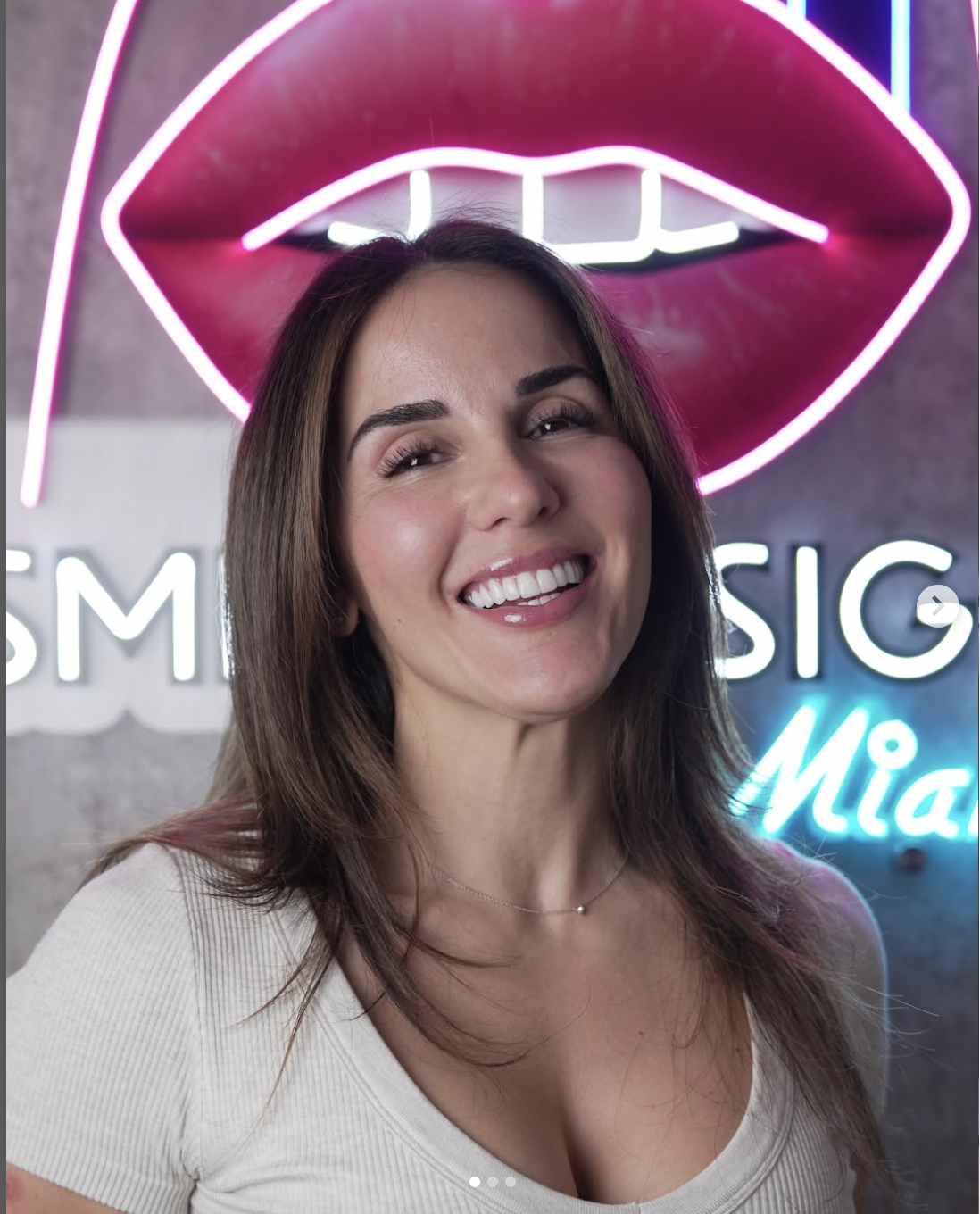 Veneers vs. Crowns